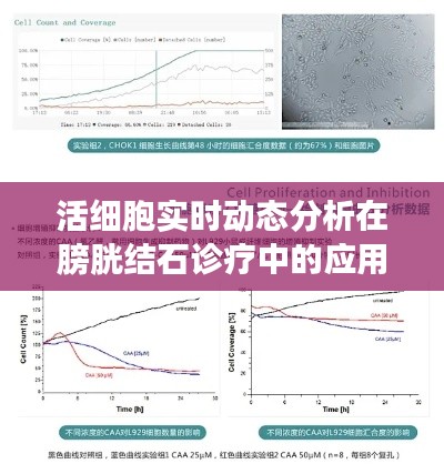 活细胞实时动态分析在膀胱结石诊疗中的应用及其价格考量